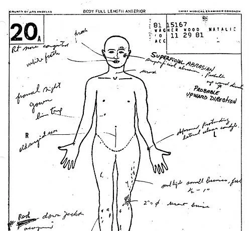 The Autopsy Report of Natalie Wood, Source: CBS News
