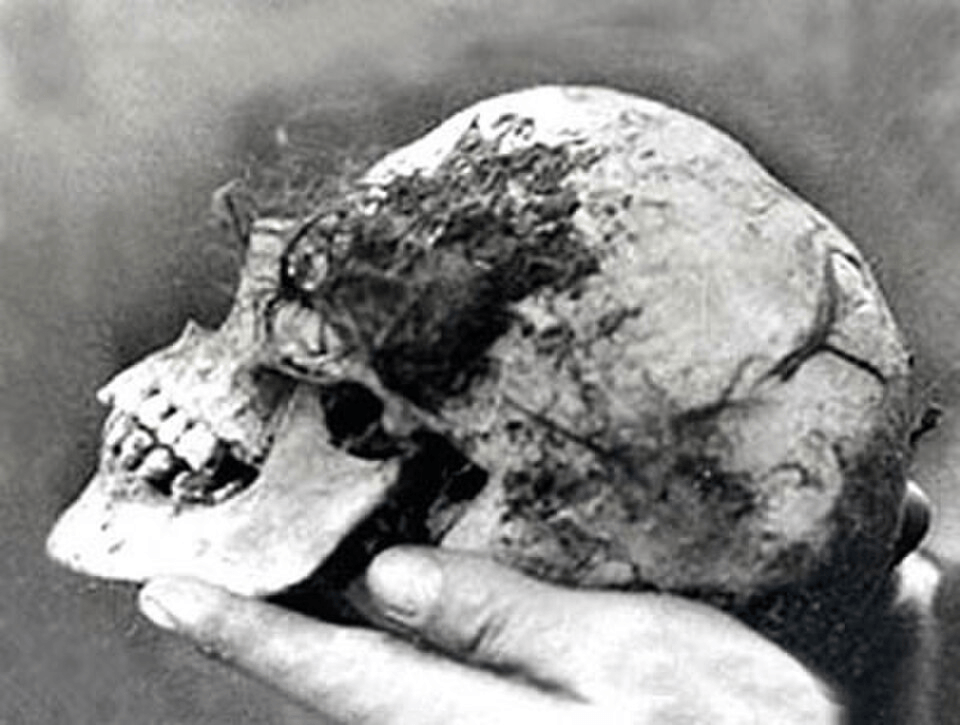 Who Put Bella in the Wych Elm? 3 Skull of the Unidentified Woman Found in the Wych Elm in Hagley Wood